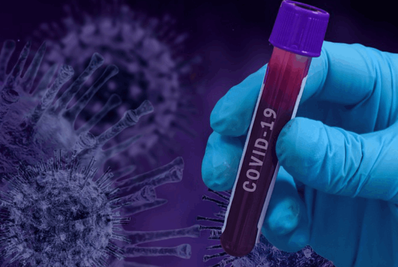 Previsão de Infecção por Covid-19 no Início da Pandemia no Brasil